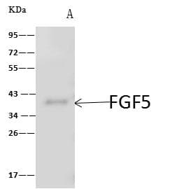 Polyclonal Rabbit anti-Human VTA1 Antibody (IF, WB)