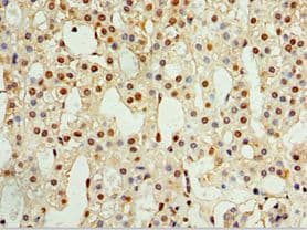 Polyclonal Rabbit anti-Human CALCB Antibody (aa1-127, IHC)