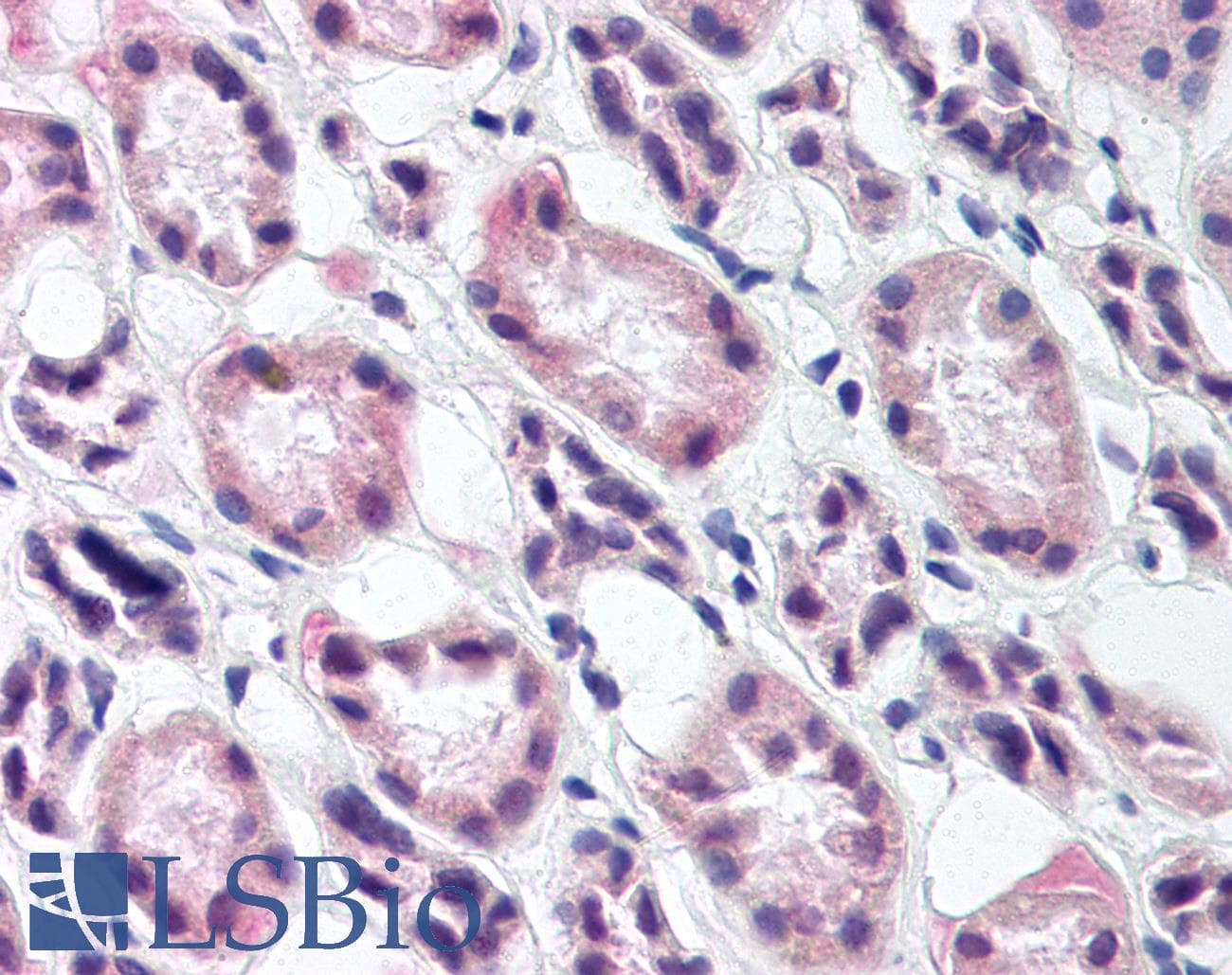 IHC-plus™ Polyclonal Rabbit anti-Mouse RREB1 Antibody (IHC, WB)