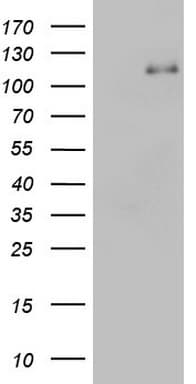 PMEL / SILV / gp100 Antibody (aa25-467, clone OTI1E5)
