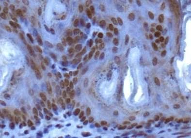 SUV420H1 Antibody (aa450-500)