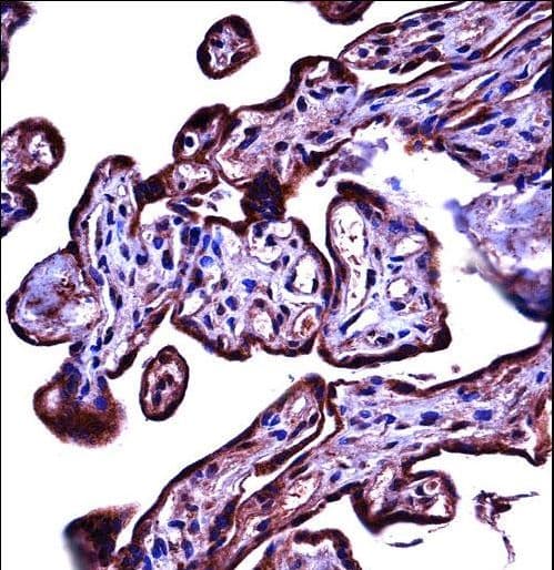 CD66d / CEACAM3 Antibody (aa163-191)