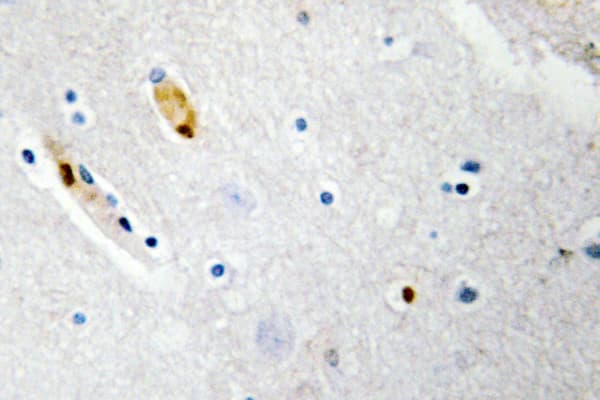 TCF3 / E2A Antibody (Asn601)