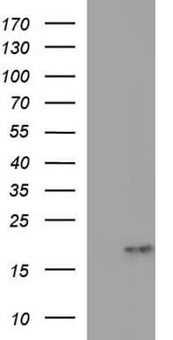 PLA2G16 / HRASLS3 Antibody (clone OTI1C9)