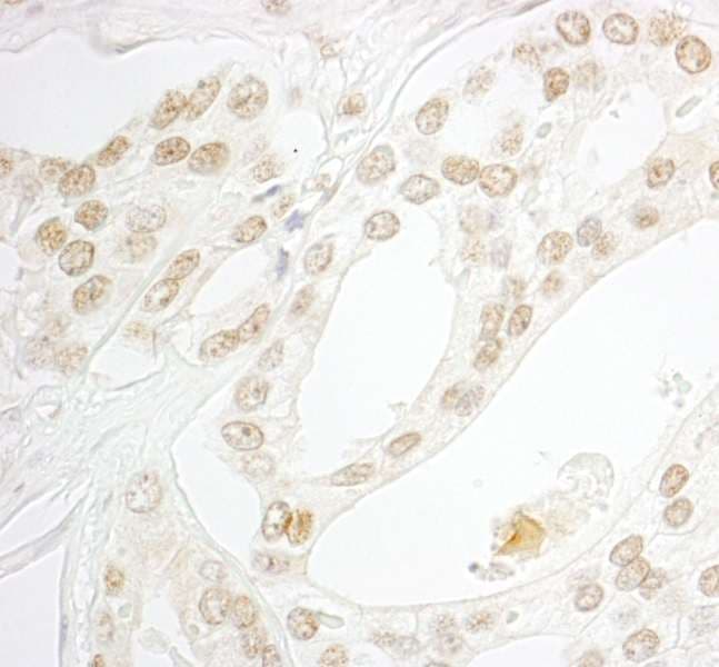 Polyclonal Rabbit anti-Human MAZ Antibody (aa427-477, IHC, WB)