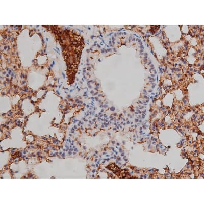 Polyclonal Rabbit anti-Human LYN Antibody (phospho-Tyr508, IHC, IF, WB)