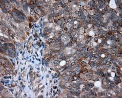 AKR1A1 Antibody (clone OTI4G6)