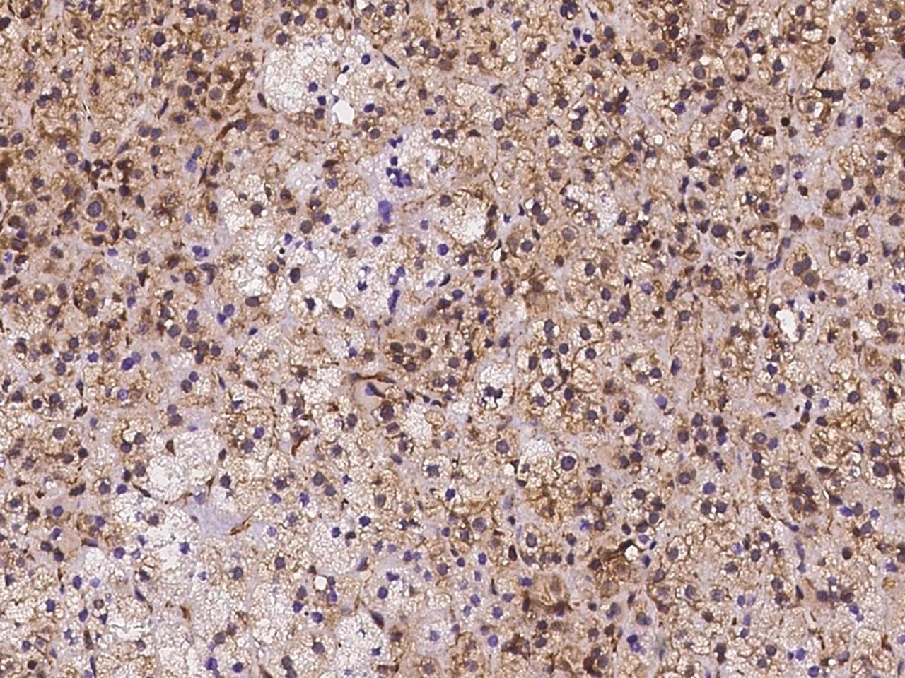 OSBPL9 Antibody