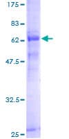Human PCID2 Protein (Recombinant GST)