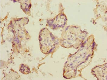 SMIF / DCP1A Antibody