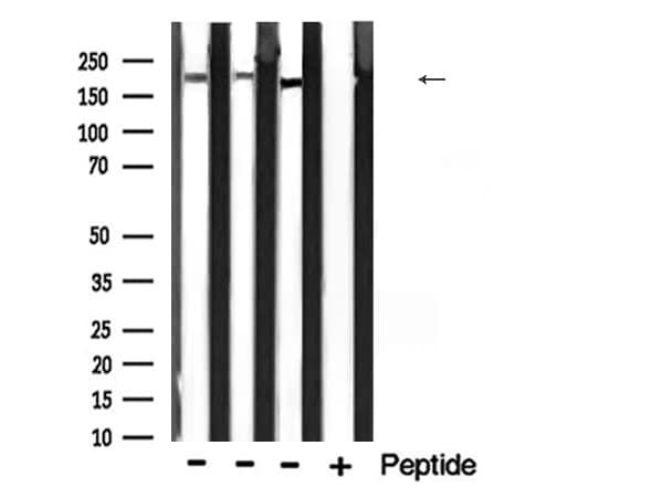 ITGB4 / Integrin Beta 4 Antibody