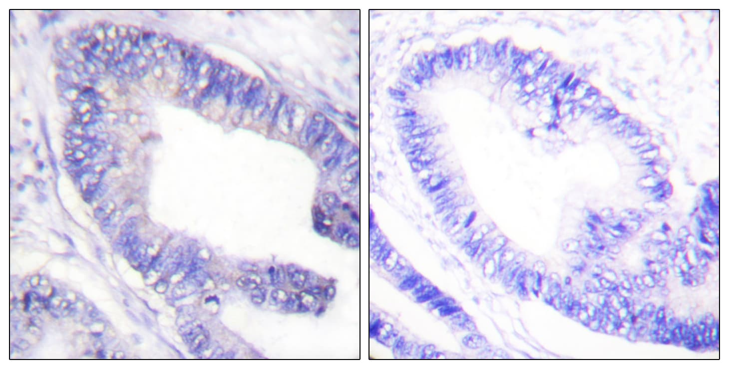 IRS1 Antibody (phospho-Ser1101)