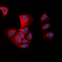 Polyclonal Rabbit anti-Human PYCARD / ASC / TMS1 Antibody (N-Terminus, IHC, IF, WB)