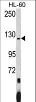 Polyclonal Rabbit anti-Human PUM2 Antibody (aa1-30, IHC, WB)