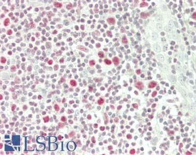 IHC-plus™ Polyclonal Rabbit anti-Human IKZF1 / IKAROS Antibody (IHC, IF, WB)