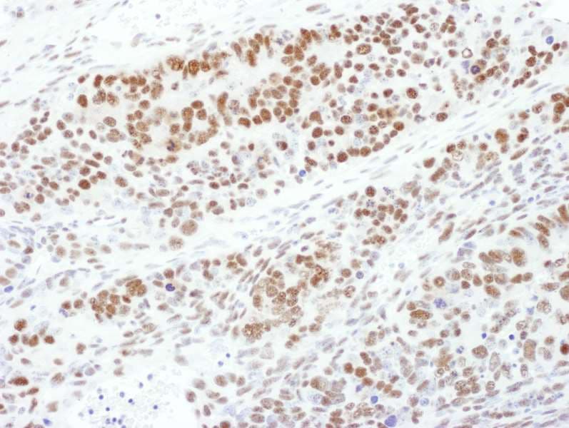 MAP2K1 / MKK1 / MEK1 Antibody (phospho-Thr286)
