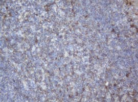PPT1 / CLN1 Antibody (clone OTI1F10)