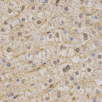 KCNQ1 / KVLQT1 Antibody