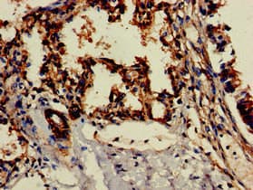 CD209 / DC-SIGN Antibody