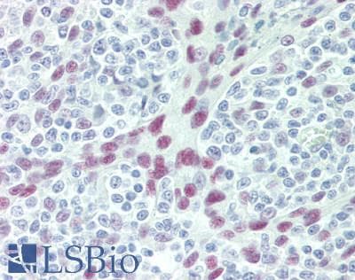 IHC-plus™ RCOR1 / COREST Antibody (aa425-C-term)