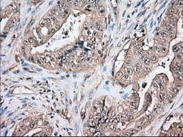 TS / Thromboxane Synthase Antibody (clone OTI1C3)