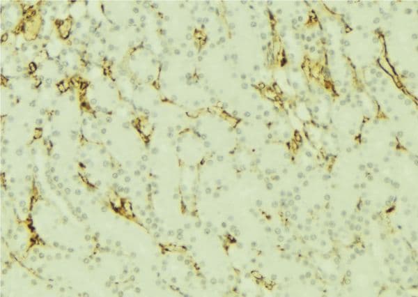 DNM1L / DRP1 Antibody