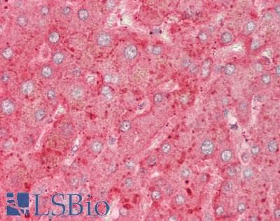 TNFSF14 / LIGHT Antibody (aa62-240)