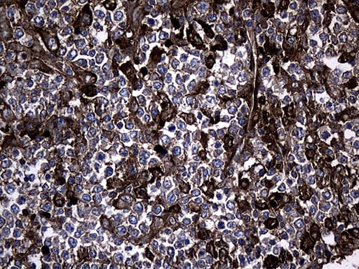 GTPCH1 / GCH1 Antibody (clone OTI1E3)