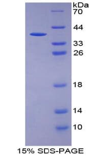 Human KRT13 / CK13 / Cytokeratin 13 Protein (Recombinant His-T7)