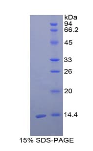 Chicken CST3 / Cystatin C Protein (Recombinant His)