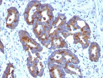 Blood Group A Antibody (clone HE-10)