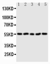 Polyclonal Rabbit anti-Mouse SDC3 / Syndecan 3 Antibody (aa45-60, IHC, WB)