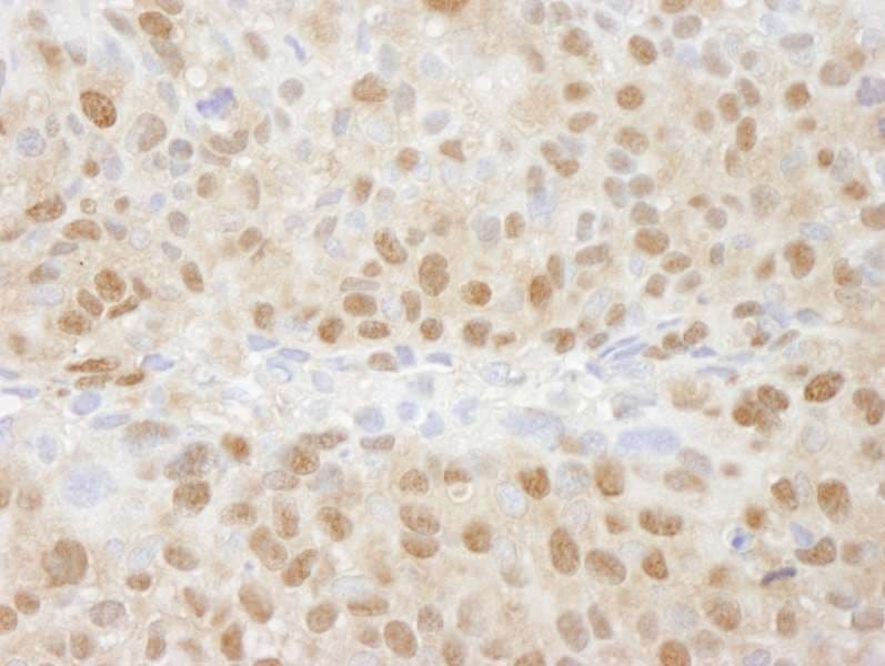 PSMC5 / SUG1 Antibody (aa1-50)
