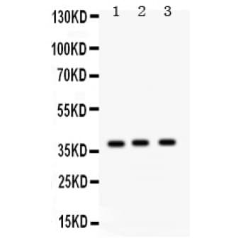 SFTPD / Surfactant Protein D Antibody (aa292-321)