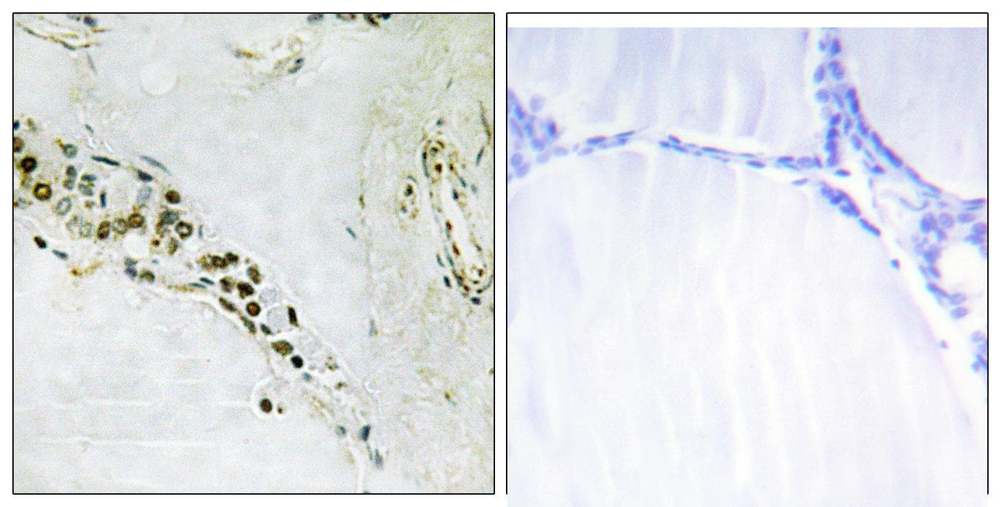 Polyclonal Rabbit anti-Human CCNE2 / Cyclin E2 Antibody (p392, IHC, IF, WB)