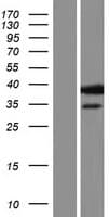 CCT7 Protein (Over-Expression Lysate Myc-DDK (Flag))