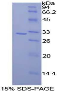 Rat CD2AP Protein (Recombinant His-T7)