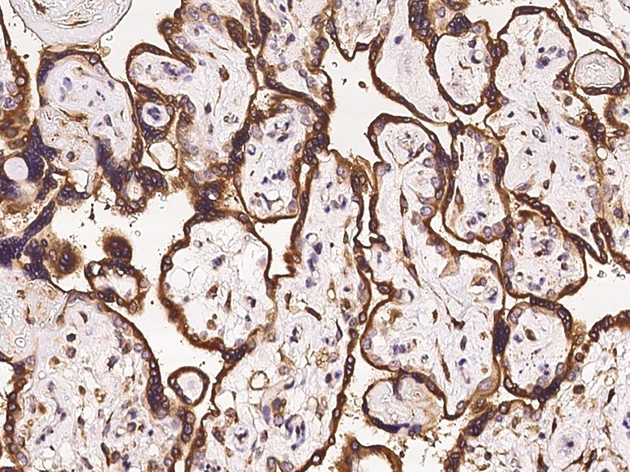 Polyclonal Rabbit anti-Human MCFD2 Antibody (IHC)