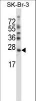 SDF2L1 Antibody (aa160-189)