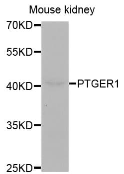 PTGER1 / EP1 Antibody