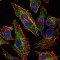 HSPB2 / HSP27 Antibody (clone 5D7)