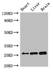 Polyclonal Rabbit anti-Human RND2 Antibody (WB)