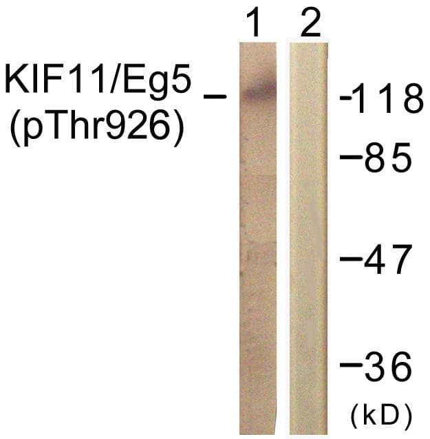 Polyclonal Rabbit anti-Human KIF11 / EG5 Antibody (phospho-Thr926, IHC, IF, WB)