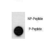 TP53 / p53 Antibody (phospho-Ser315)