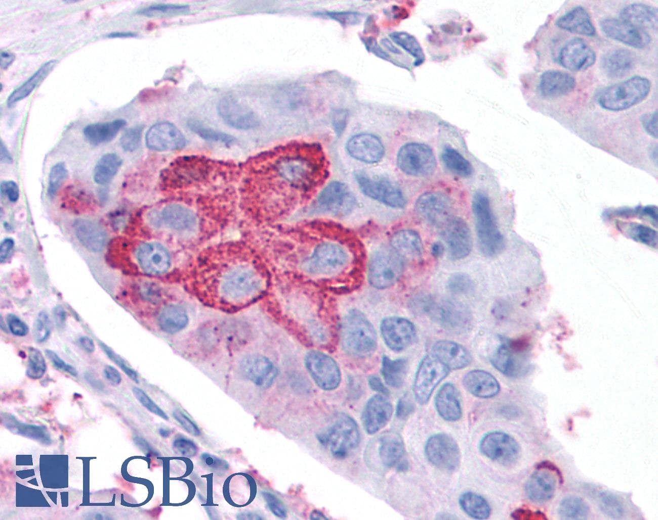 PathPlus™ Polyclonal Rabbit anti-Human RORC / ROR Gamma Antibody (Ligand-binding Domain, IHC)