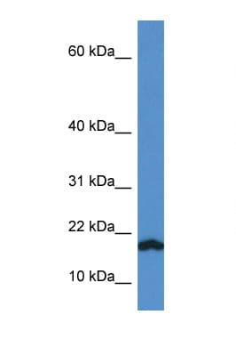VAMP1 / VAMP-1 Antibody (C-Terminus)