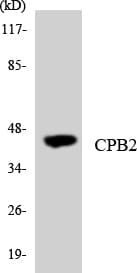 Polyclonal Rabbit anti-Human CPB2 / TAFI Antibody (aa306-355, WB)
