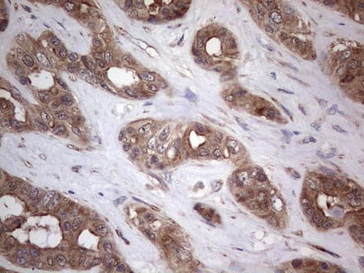 PIK3CA / PI3K Alpha Antibody (aa303-631, clone OTI6D1)