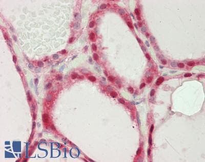 IHC-plus™ YAP / YAP1 Antibody (aa350-400)