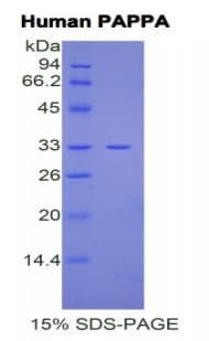 Human PAPPA / PAPP-A Protein (Recombinant His)